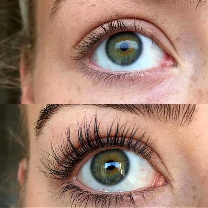 Photo avant/après montrant une croissance spectaculaire des cils et un gain de volume grâce au sérum pour cils avancé QUALASH