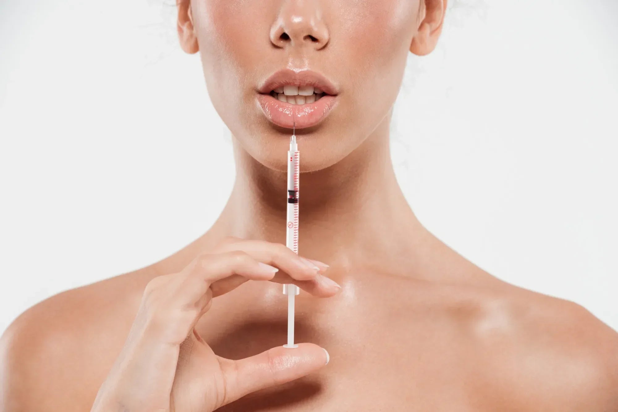  Lips After Hyaluronic Acid Fillers